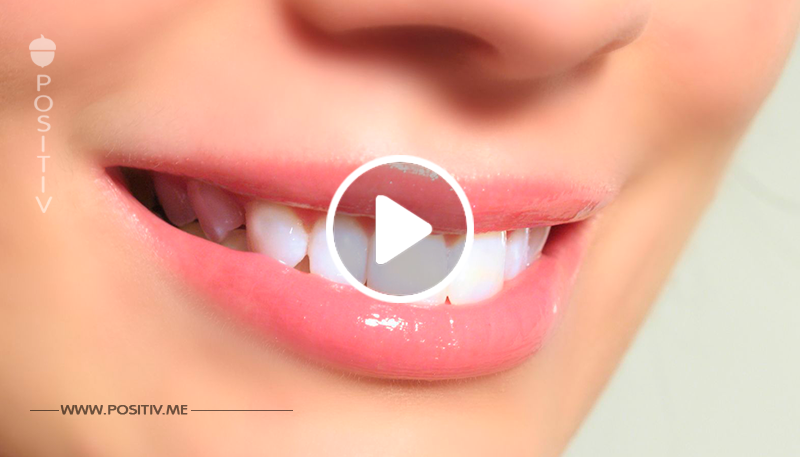 Plaque: Hier ist ein einfacher Hausfrauentrick, der Ihren Zähnen helfen wird