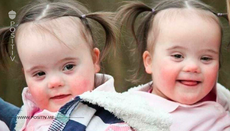 Nach der Geburt ihrer Zwillinge sind die Eltern überglücklich – da eröffnet ihnen der Arzt, dass es ihm „Leid tut“