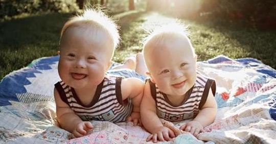 Außergewöhnliche Zwillingsbrüder mit Down Syndrom sind ein inspirierendes Beispiel für Freude