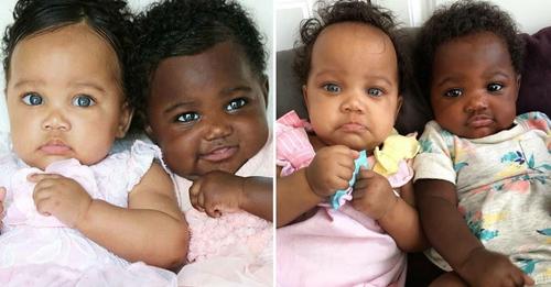 Zwillinge mit unterschiedlichen Hautfarben wurden weltweit bekannt – so sehen sie heute, 5 Jahre später, aus