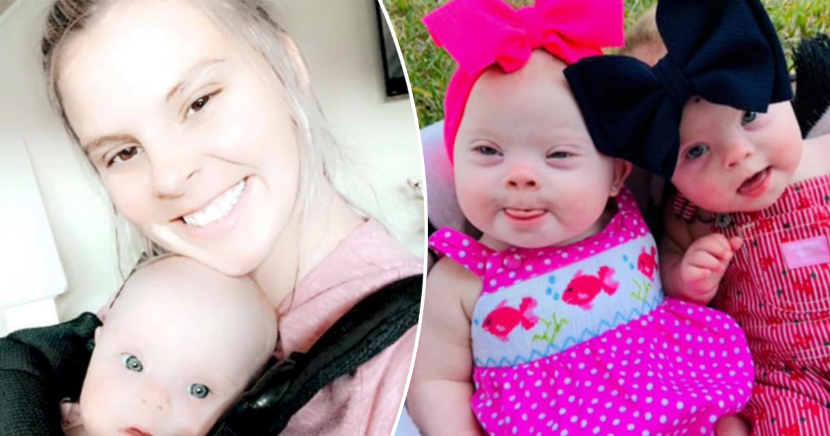 Frau aus den USA bringt eineiige Zwillinge mit Down-Syndrom zur Welt – seltenes Ereignis